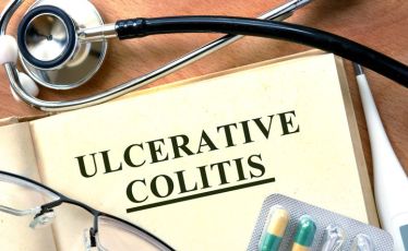ulcerative colitis