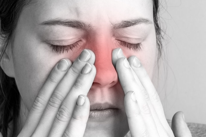 sinusitis
